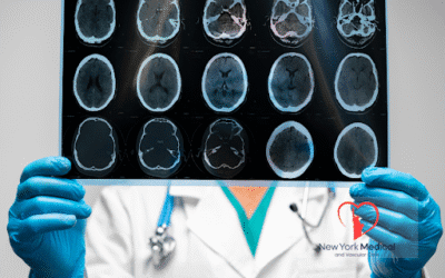 One Roof, One Team: Inside NYMVCare’s Comprehensive Headache & Neurology Evaluations